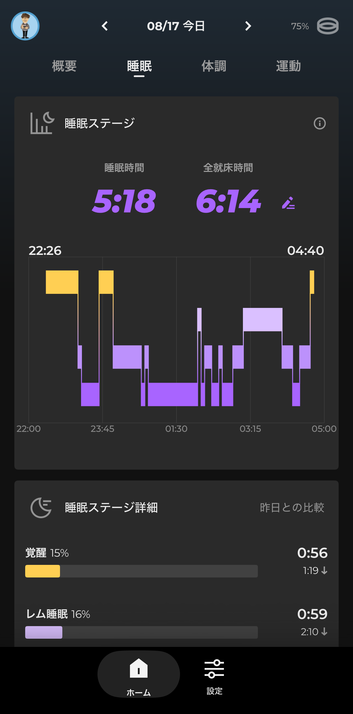 SOXAIアプリの睡眠ステージ画面